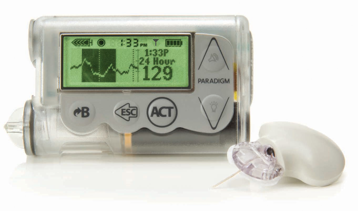 Traveling on an airplane for the first time with Animas Vibe pump. Any